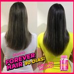 resultado-forever-hair-3-meses