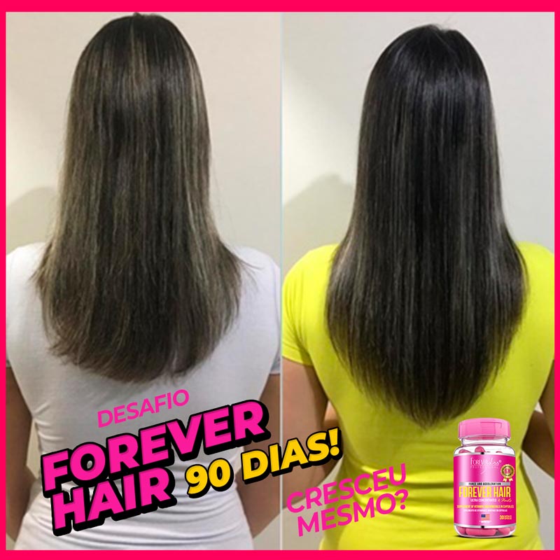 resultado-forever-hair-3-meses